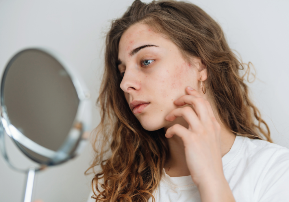 Trockene Haut: Wenn der Feuchtigkeits-Booster fehlt💧