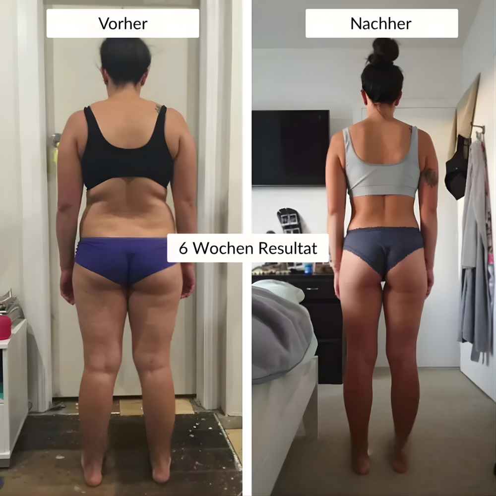 Wochenbett Anti-Cellulite Leggings